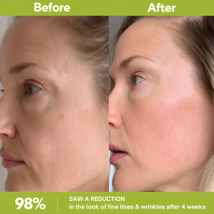 Retinal Shot – Advanced Anti-Aging Booster