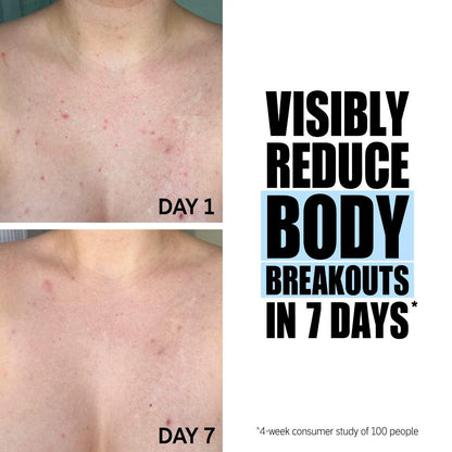 SmoothGlow™ Ingrown Hair & Soothing Serum – 1+1 FREE